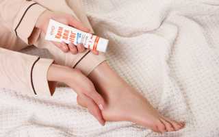 Трескаются пятки причины и лечение. Мази, витамины, народные средства в домашних условиях