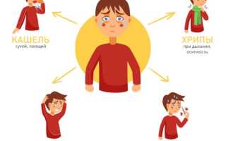 Аллергический ларингит. Лечение у ребенка, симптомы, препараты