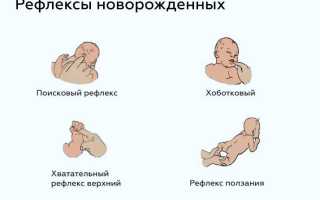 ДЦП (детский церебральный паралич). Причины у детей, что это такое, лечится или нет