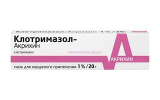 Лечение вульвита у женщин: схема, препараты, мази