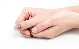 Травма ногтя руки — повреждение ногтевой пластины