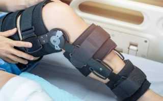 Реабилитация после пластики передней крестообразной связки. Восстановление