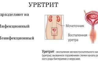 Уретра у женщин, мужчин. Что это такое, анатомия, где находится, функции, заболевания