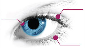 Ячмень на глазу — симптомы и лечение