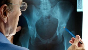 Хирургическое вмешательство Хирургическое вмешательство