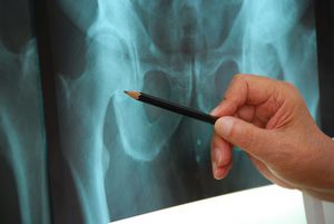 Симптомы некроза Симптомы некроза