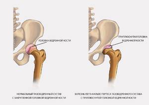 Исход и этап лечения Этапы лечения