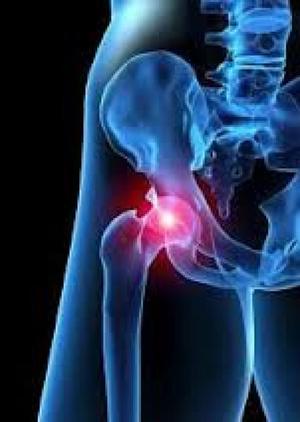 Функциональная анатомия тазобедренного сустава Анатомия тазобедренного сустава