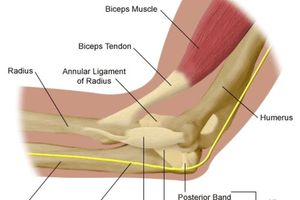 Причины боли в локте