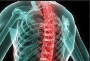 Симптомы заболевания Какие симптомы у болезни Бехтерева