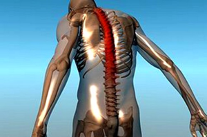 Диагностирование болезни Бехтерева Как лечат болезнь Бехтерева