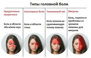 Головная боль - разные виды