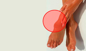 Особенности лечения  гигромы