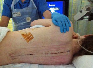 Когда необходимо снимать конструкцию