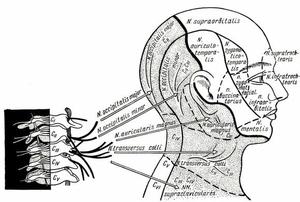 Как вылечить остеохондроз