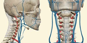 Головные боли при заболевании  остеохондроз