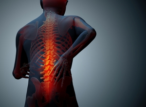 Болезнь суставов Что такое болезнь бехтерева