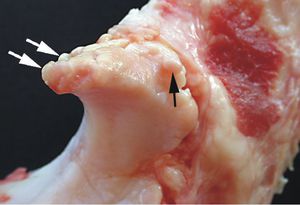 Как лечить шипы на позвоночнике