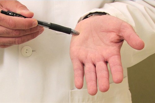 Когда потеют руки - что делать?