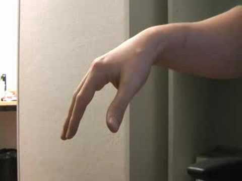 Опасность тремора: почему трясутся руки при волнении