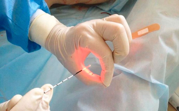 Абактериальный хронический простатит. Что это, симптомы, лечение