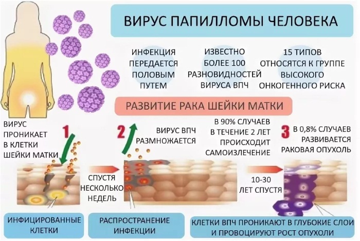 Анализ крови на папилломавирус у женщин, мужчин, детей. Причины ВПЧ инфекции
