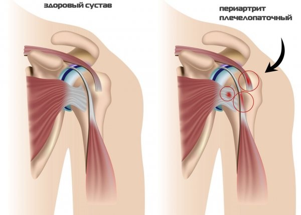 Боль под левой грудиной у женщин спереди при дыхании, движении, нажатии, после еды. Причины и что делать