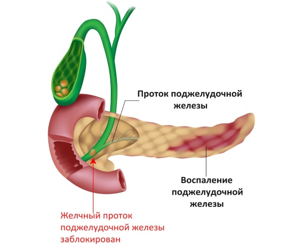 Боль под левой грудиной у женщин спереди при дыхании, движении, нажатии, после еды. Причины и что делать