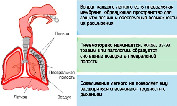 Боль под левой грудиной у женщин спереди при дыхании, движении, нажатии, после еды. Причины и что делать