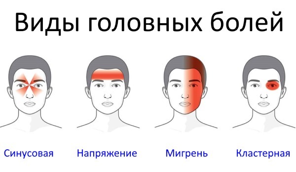 Болит голова в висках. Причины, если тошнит, давит на глаза, слева, справа, пульсирующая, сильная, давящая, тупая. Что делать