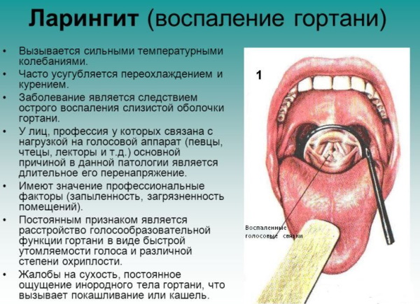 Болит горло только по ночам, а днем не болит