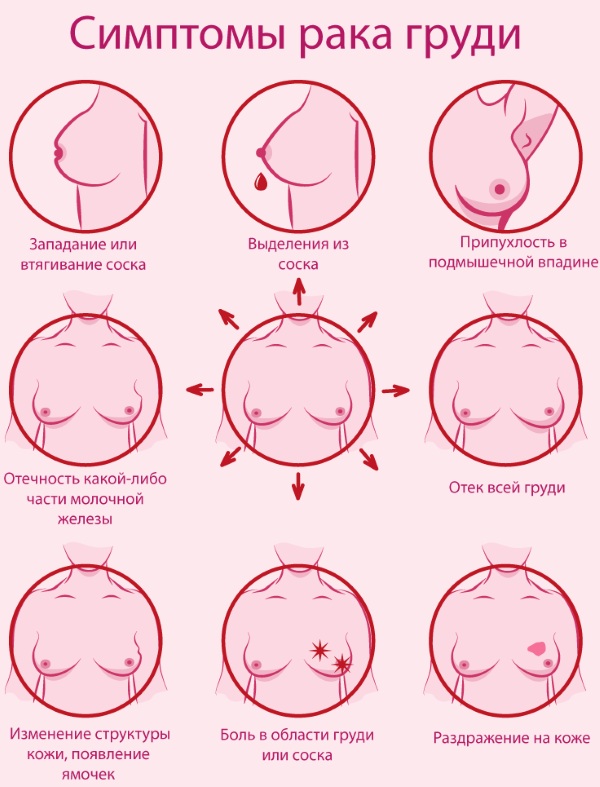 Болит грудь в середине цикла, второй половине, весь цикл. Почему набухла, что делать