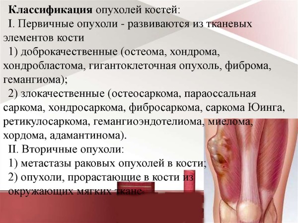 Болит поясница. Причины у женщин после сна, при месячных, беременности, сзади, слева, справа. Лечение