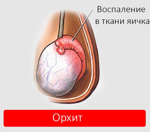 Болит правый, левый бок в районе талии со спины, сбоку, спереди у мужчин, женщин. Что делать