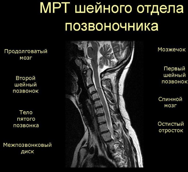 Болит шея сзади, слева, справа, сбоку. Причины, чем лечить