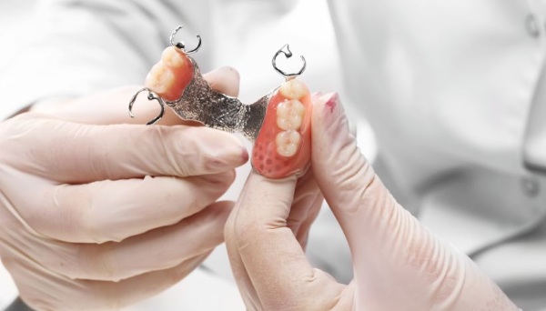 Бюгельные протезы на нижнюю/верхнюю челюсть. Фото на кламмерах, аттачменах, замках, шинирующий, квадротти