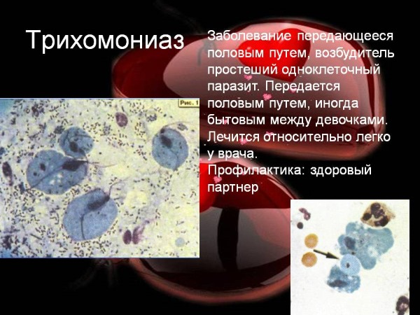 Дискомфорт в интимной зоне у женщин. Причины и лечение зуда, жжения, покраснения, сухости, раздражения, выделений