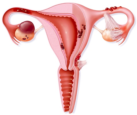 Дугласово пространство в анатомии. Что это, где находится, переднее и заднее, топография, границы, жидкость, метастаз, абсцесс