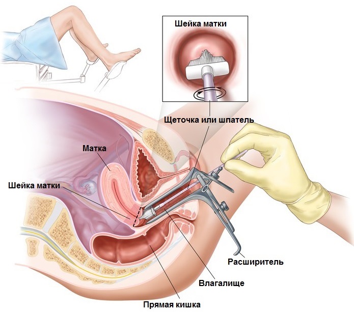 Дугласово пространство в анатомии. Что это, где находится, переднее и заднее, топография, границы, жидкость, метастаз, абсцесс