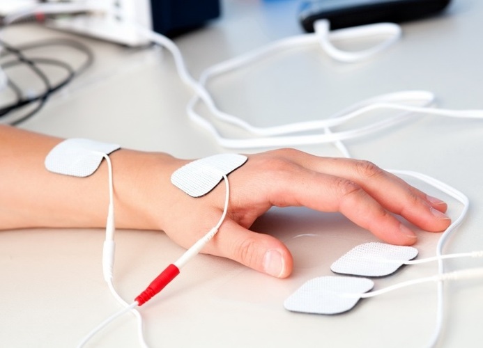 Покалывание в руках и ногах как иголки одновременно. Причины, лечение