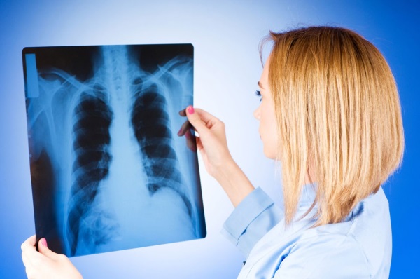 Фиброзные изменения в легких. Что это, причины, фото диффузные, локальные, после пневмонии, послеоперационные. Как лечить