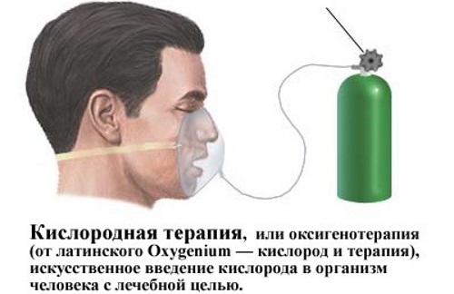 Фиброзные изменения в легких. Что это, причины, фото диффузные, локальные, после пневмонии, послеоперационные. Как лечить