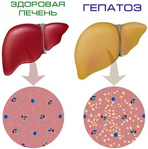 Пальпация печени по Курлову. Методика, алгоритм, этапы проведения, норма