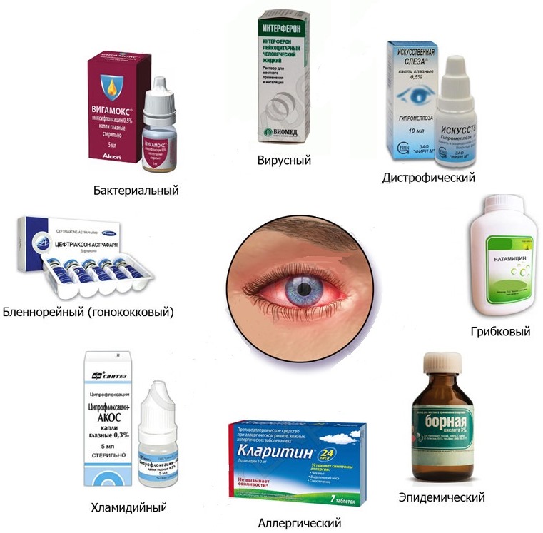 Лучшие глазные капли от покраснения и раздражения с отзывами и ценой: Визин, Тауфон, Эмоксипин, Левомицетин, Окуметил