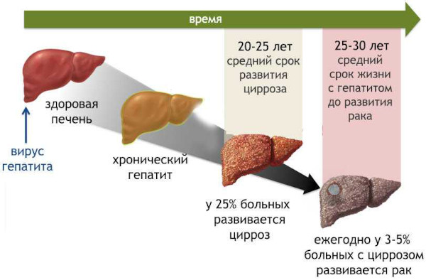 Глутатион (Глатион) капельница. Инструкция по применению, цена, отзывы