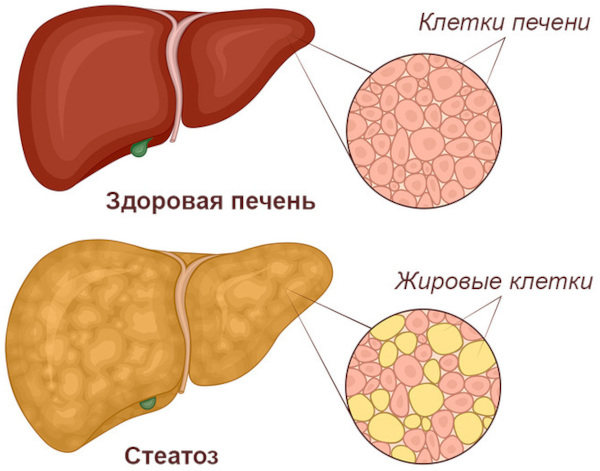 Глутатион (Глатион) капельница. Инструкция по применению, цена, отзывы