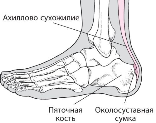 Голеностопный сустав опухает и болит после травмы, бега. Причины, лечение