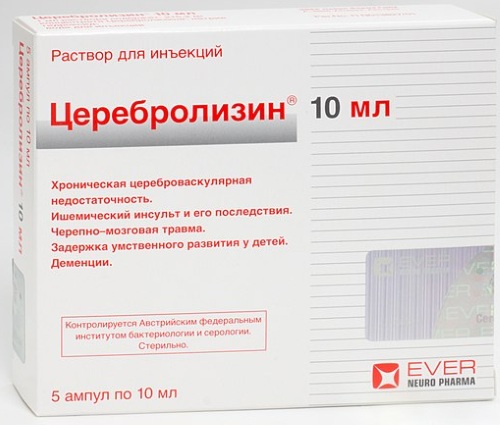 Боль в висках пульсирующая, в затылке, глазах: причины и лечение