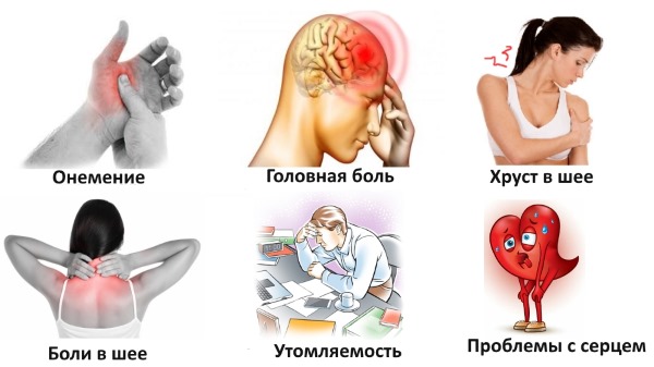 Головные боли у женщин. Причины, лечение цервикокраниалгии, сосудистых напряжений, кластерных, в виске, затылке, лобной части