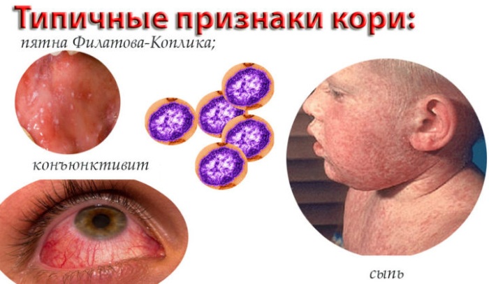 Гропринозин 500. Инструкция по применению, таблетки, сироп. Цена, аналоги